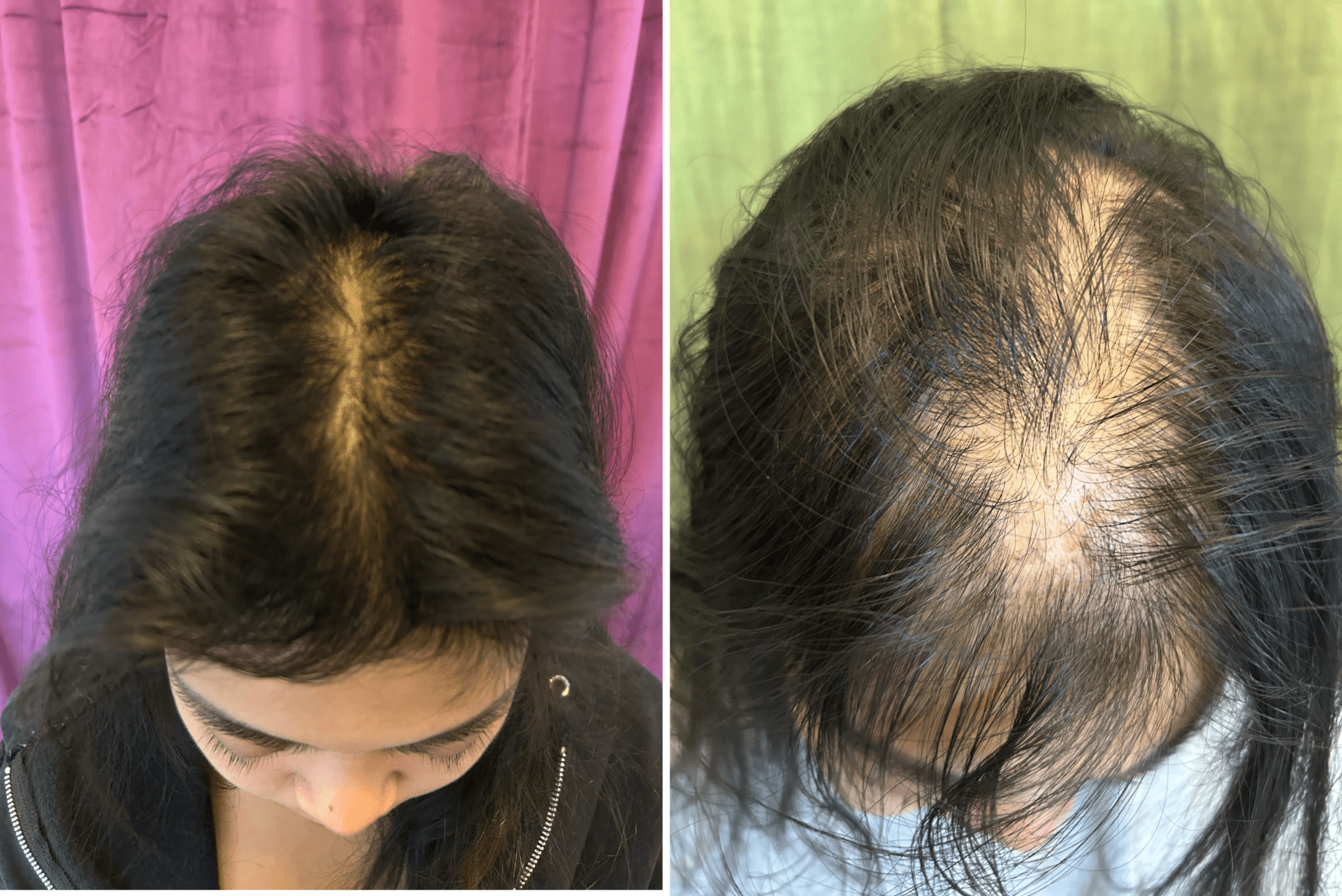 AA blog 2 before