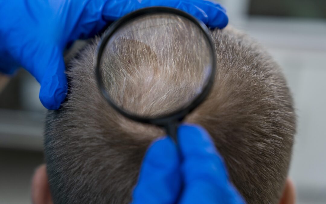 How Functional Medicine Complements Trichology: A Root-Cause Approach to Hair and Scalp Health